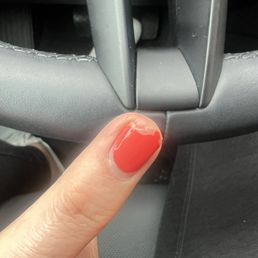 This is the current state of my nails. They are very sensitive and keep peeling.