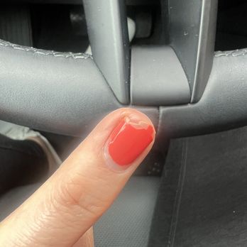 Aria Nail Spa - This is the current state of my nails. They are very sensitive and keep peeling. - Nail Technicians Near Me - Chicago, Illinois