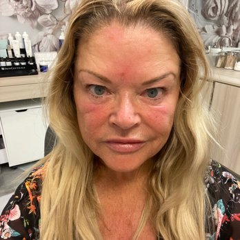 Infuze Aesthetics & Wellness - Fresh dewy skin! - Medical Spas Near Me - Henderson, Nevada Infuze Aesthetics & Wellness - Fresh dewy skin! - Medical Spas Near Me - Henderson, Nevada