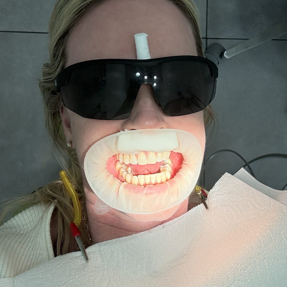 Smile Tijuana Dentist - General Dentistry Near Me - Tijuana, BCN Smile Tijuana Dentist - General Dentistry Near Me - Tijuana, BCN