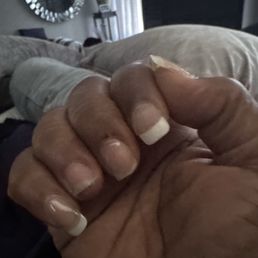 My acrylic broke off and took my natural nail away. Poor quality powder and it's peeling and turning yellow. My acrylic broke off and took my natural nail away. Poor quality powder and it's peeling and turning yellow.