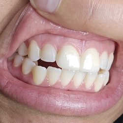 Advanced Smile Center