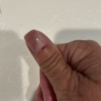 8 Pretty Nails and Spa - Another damaged cuticle - Nail Salons Near Me - Surprise, Arizona