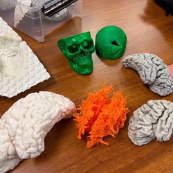 North End Makerspace - 3D printed from brain mri images