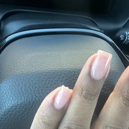 Went over the skin with the electric file. Broken skin