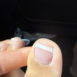 Aledo Nails & Spa - The nails in question