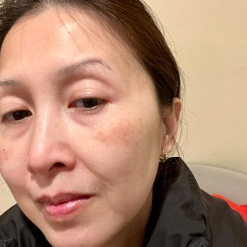 Chez Sylva - Before my facial treatment - Skin Care Near Me - San Francisco, California Chez Sylva - Before my facial treatment - Skin Care Near Me - San Francisco, California