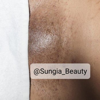 Sungia Beauty - Brazilian sugaring after - Sugaring Near Me - Lancaster, California Sungia Beauty - Brazilian sugaring after - Sugaring Near Me - Lancaster, California