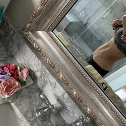 This was today. I've had lots of water and have eaten breakfast and lunch. This is about 2wks after my cool sculpting procedure. This was today. I've had lots of water and have eaten breakfast and lunch. This is about 2wks after my cool sculpting procedure.