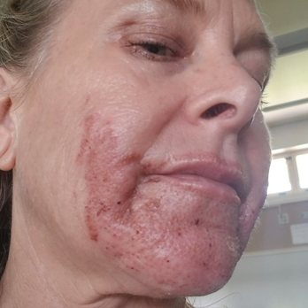 Aesthetics Hawaii - day two - Medical Spas Near Me - Honolulu, Hawaii Aesthetics Hawaii - day two - Medical Spas Near Me - Honolulu, Hawaii