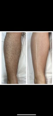 "Smooth skin ahead! ✨ Say goodbye to unwanted hair with our expert waxing services. #WaxingQueen #SilkySmooth" - "Smooth skin ahead! ✨ Say goodbye to unwanted hair with our expert waxing services. #WaxingQueen #SilkySmooth" "Smooth skin ahead! ✨ Say goodbye to unwanted hair with our expert waxing services. #WaxingQueen #SilkySmooth" - "Smooth skin ahead! ✨ Say goodbye to unwanted hair with our expert waxing services. #WaxingQueen #SilkySmooth"