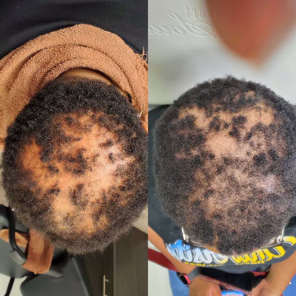 THE ALOPECIA DOCTOR HAIR AND SCALP SPA Request an Appointment 1415