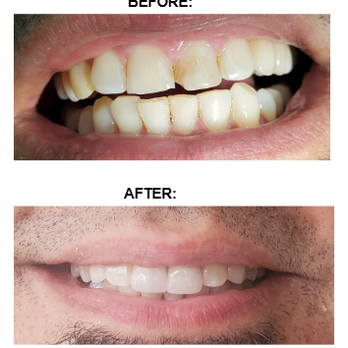 Maria Lobodzinski, DDS - Prosthodontists Near Me - Pasadena, California Maria Lobodzinski, DDS - Prosthodontists Near Me - Pasadena, California