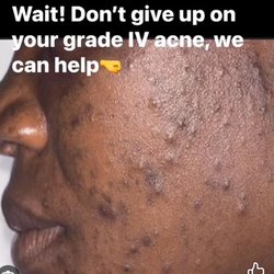 Advanced Beauty Day Spa