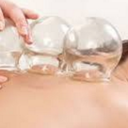 Elite Wellness North Shore - Cupping Therapy at Elite