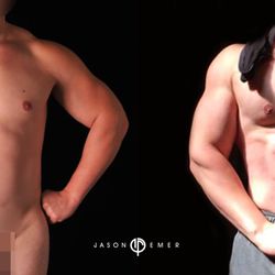 JASON EMER, MD - 914 Photos & 365 Reviews - Dermatologists - 9201