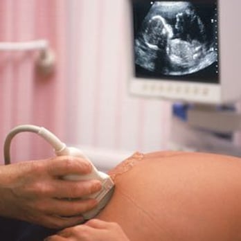 L.A.B. Look At Baby - L.A.B. Look At Baby - Mobile Ultrasound Test, 3D Ultrasound - Diagnostic Imaging Near Me - Orange, Texas L.A.B. Look At Baby - L.A.B. Look At Baby - Mobile Ultrasound Test, 3D Ultrasound - Diagnostic Imaging Near Me - Orange, Texas