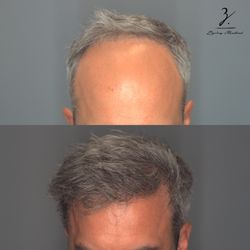 Ziering Medical