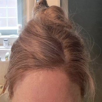 Cake Salon - Haircolor was left all over my skin. Tried to get it off. Hair broken off and spot with no hair - Hair Salons Near Me - Edmond, Oklahoma Cake Salon - Haircolor was left all over my skin. Tried to get it off. Hair broken off and spot with no hair - Hair Salons Near Me - Edmond, Oklahoma