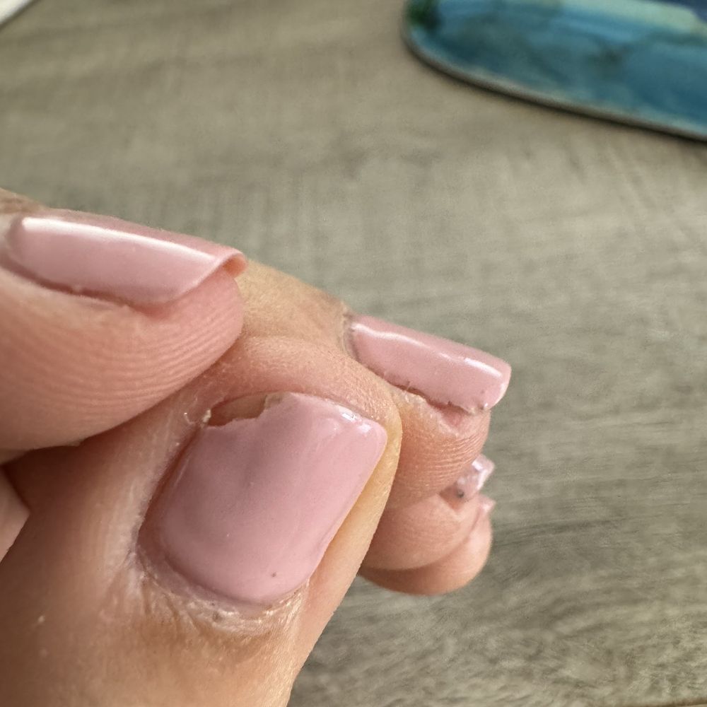 Diamond Nails - L hand chipping - Nail Salons Near Me - Murfreesboro, Tennessee Diamond Nails - L hand chipping - Nail Salons Near Me - Murfreesboro, Tennessee