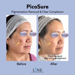 Line Plastic Surgery Center