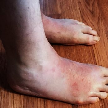 Steven Levy, DPM - undefined - Podiatrists Near Me - Oradell, New Jersey Steven Levy, DPM - undefined - Podiatrists Near Me - Oradell, New Jersey