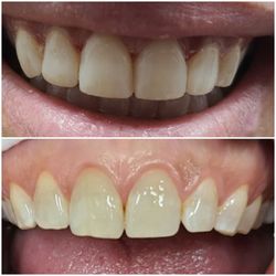 Smile Arts Dentistry