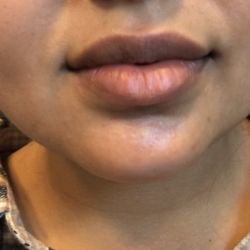 Beautify Agency - Before