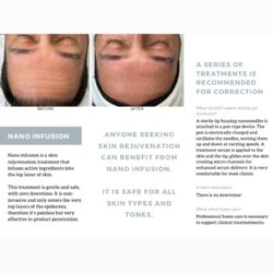 Bliss Face & Body - Nano infusion