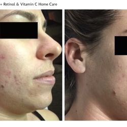 Skin Care By Marlene