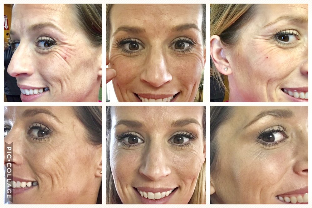 Ten Years Younger Logo