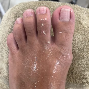 Milano Nails - Ingrown on my left side - Nail Salons Near Me - Henderson, Nevada