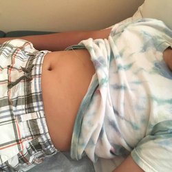 Beverly Hills Acupuncture & Herbology Medical Ctr - 9-year-old with needles