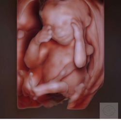 Love at First Sight - Second Love Package
16 weeks 3