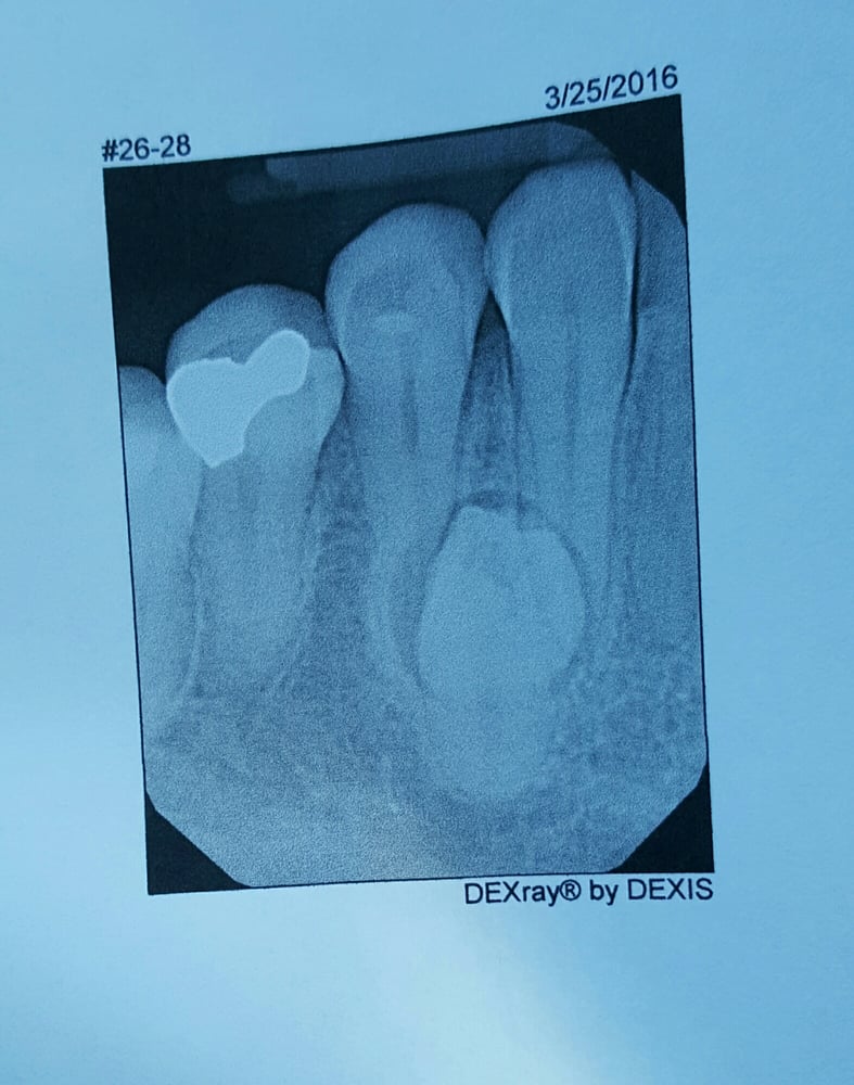 ASHOK N. VEERANKI, DDS, FIBCSOMS, FACS Updated September 2024 37