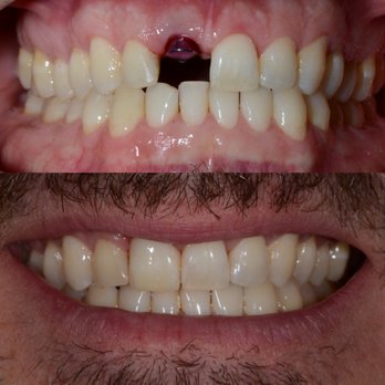 Boulder Canyon Dental - Orthodontists Near Me - Boulder, Colorado Boulder Canyon Dental - Orthodontists Near Me - Boulder, Colorado