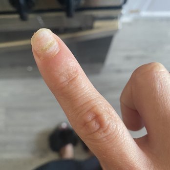 Pinks Nail Spa - Fungus from getting my nails done here. - Nail Salons Near Me - Los Angeles, California