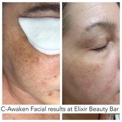 Elixir Beauty Bar - Looking for results? You will find them at Elixir Beauty Bar!