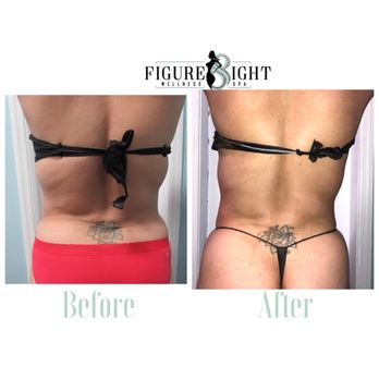 Figure 8ight Wellness Spa - PureSculpt Body - Skin Care Near Me - West Park, Florida Figure 8ight Wellness Spa - PureSculpt Body - Skin Care Near Me - West Park, Florida