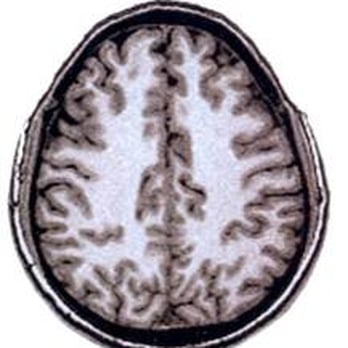 IRIS - Centre d'Imagerie des Bois Blancs - Diagnostic Imaging Near Me - Lille, 59 IRIS - Centre d'Imagerie des Bois Blancs - Diagnostic Imaging Near Me - Lille, 59