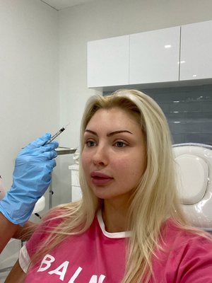 Botox Injections - This is Dina Sipovich Ferry the owner of Cosmetica Med Spa before and after Botox Injections. She now gets all her treatments done at her own medspa.