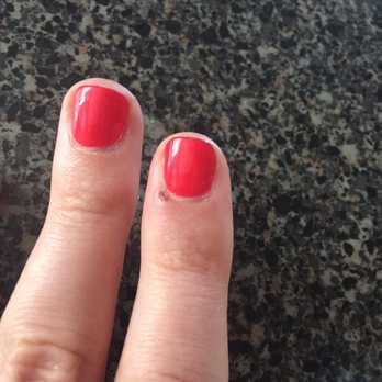Zenails - Mani injury - Nail Salons Near Me - Chicago, Illinois Zenails - Mani injury - Nail Salons Near Me - Chicago, Illinois