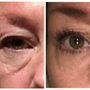 Photo of Beautiful Laser Center