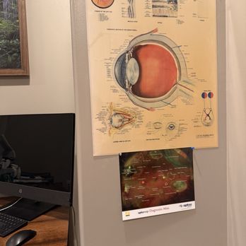 Beaverton Vision World - All the eyes - Optometrists Near Me - Beaverton, Oregon Beaverton Vision World - All the eyes - Optometrists Near Me - Beaverton, Oregon