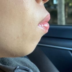 NakedMD - Sacramento - Two weeks later