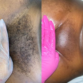 Soft Skin - Brazilian Wax - Waxing Near Me - Southfield, Michigan Soft Skin - Brazilian Wax - Waxing Near Me - Southfield, Michigan