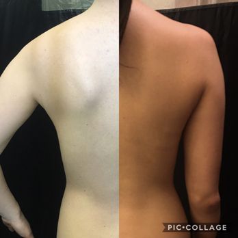 Diamond Tans - Before & After - Spray Tanning Near Me