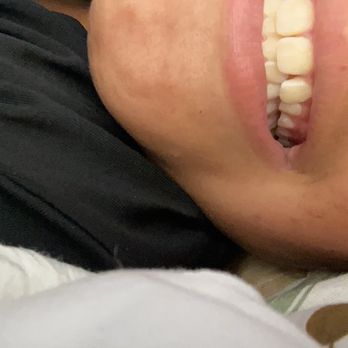 Priceless Dental Group - they did so good on my teeth - Cosmetic Dentists Near Me - Santa Rosa, California Priceless Dental Group - they did so good on my teeth - Cosmetic Dentists Near Me - Santa Rosa, California