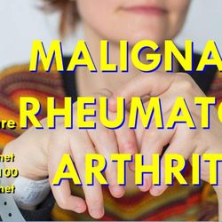 KOSA Acupuncture - Malignant Rheumatoid Arthritis Treatment By KOSA Acupuncture