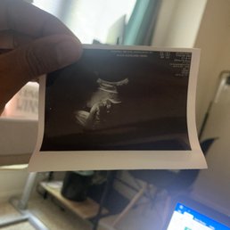 What the hell kind sonogram is this for a patient that's 8.5 months pregnant (lazy) ..... What the hell kind sonogram is this for a patient that's 8.5 months pregnant (lazy) .....